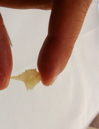 Dentición en El Grado